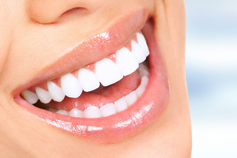Bimbli Smiles Dental Special Offer