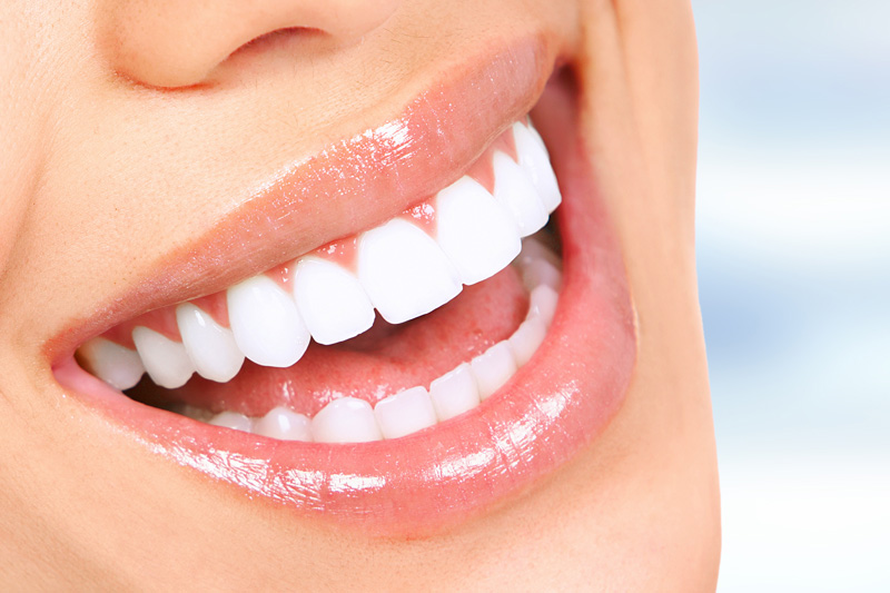 Cosmetic Dentistry in Culver City